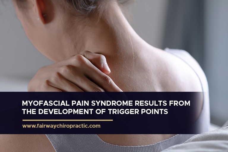 Myofascial Pain Syndrome results from the development of trigger points