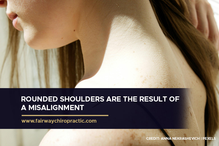 Rounded shoulders are the result of a misalignment