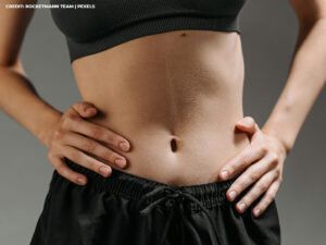 Say Goodbye to Hip Pain: Your Guide to Lacrosse Ball Hip Release