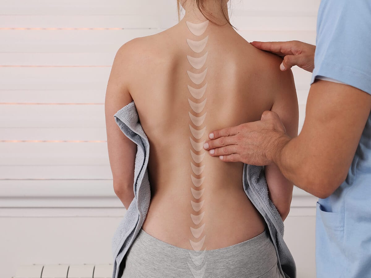Postural correction support in Chiropractic care
