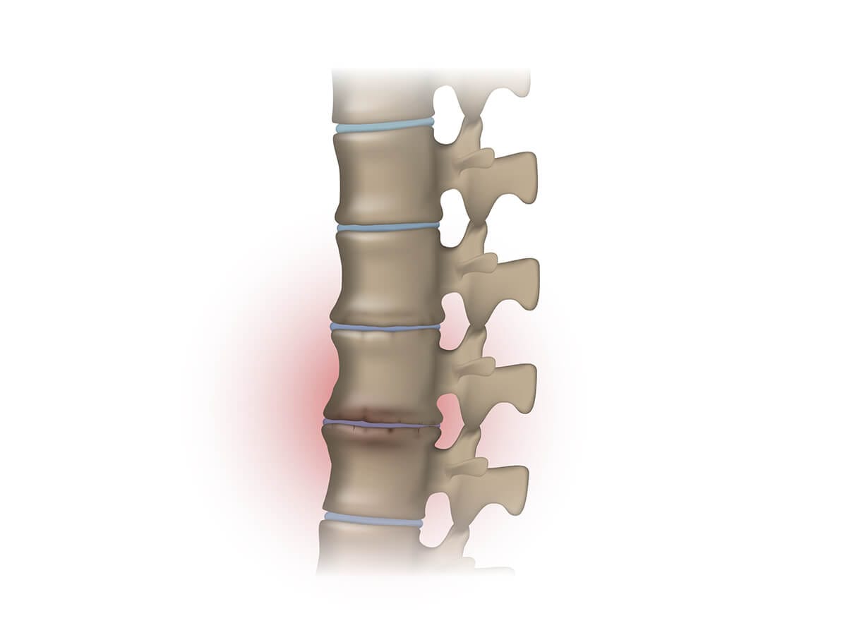 How Long Does Natural Healing Take?