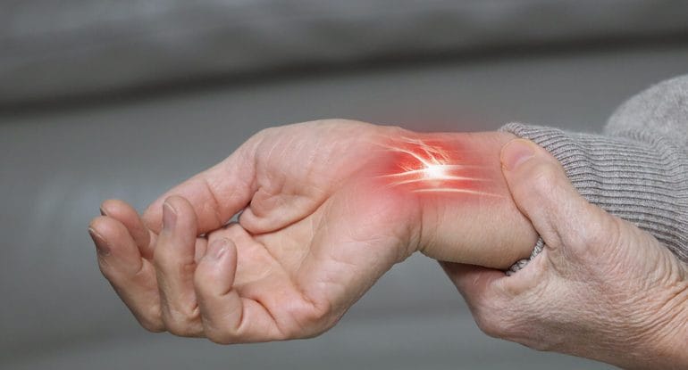 Can Chiropractic Help Carpal Tunnel Syndrome?