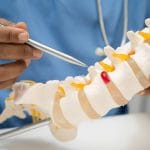 Can Chiropractic Make a Disc Herniation Worse?