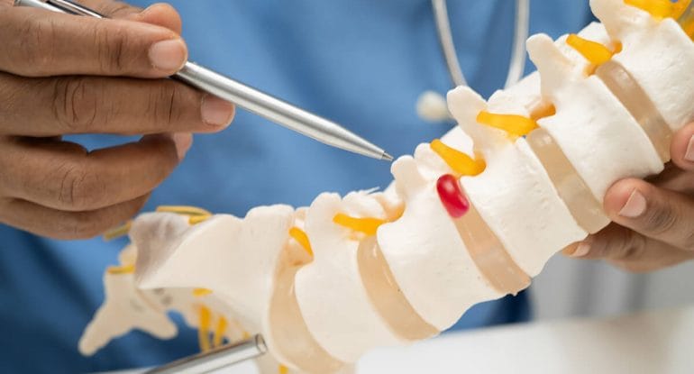 Can Chiropractic Make a Disc Herniation Worse?