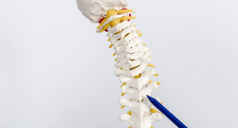 Doctor demonstrating facet joints on a spine model to explain causes of facet joint syndrome and back pain