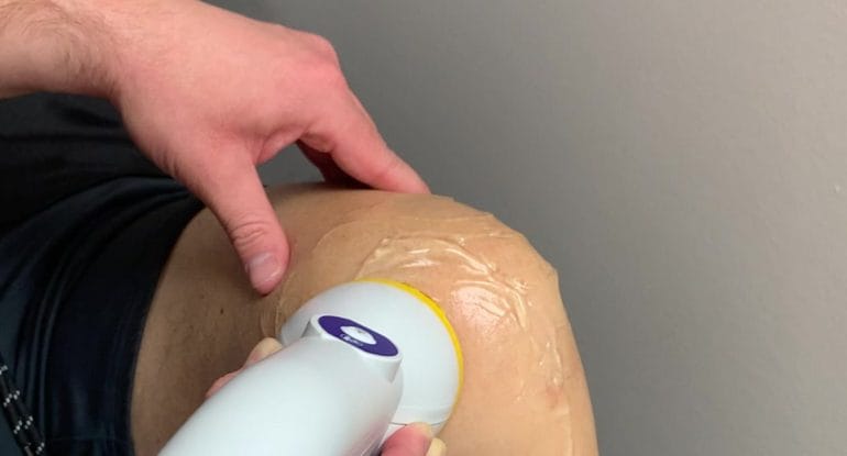 SoftWave Tissue Regenerative Therapy applied to a patient knee for arthritis at Fairway Chiropractic Centre in Kitchener